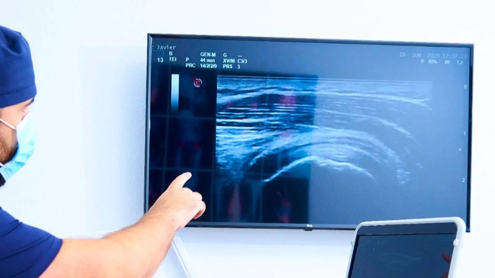 ¿Es siempre necesaria la cirugía? El papel de la segunda opinión médica en la toma de decisiones